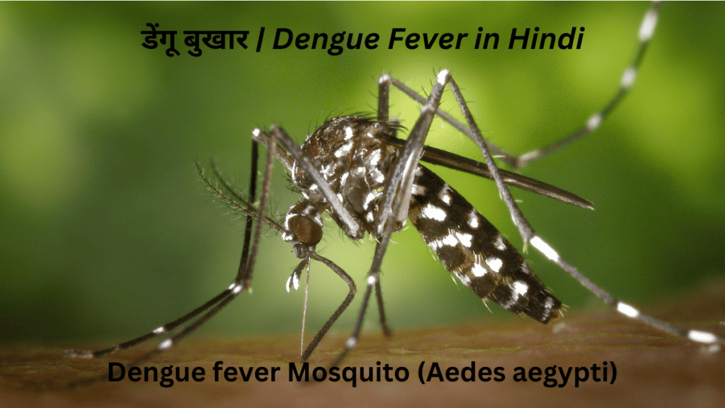 डेंगू बुखार | Dengue Fever in Hindi